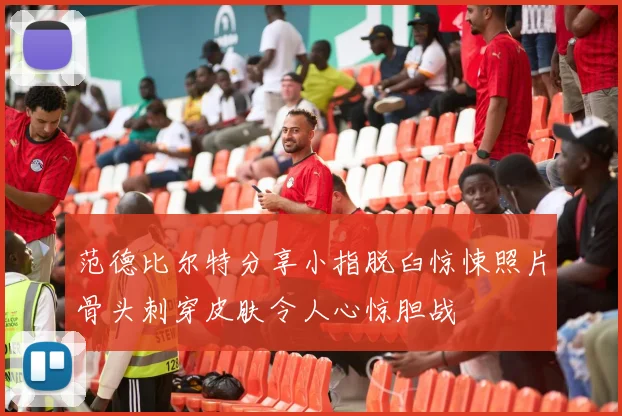 范德比尔特分享小指脱臼惊悚照片骨头刺穿皮肤令人心惊胆战
